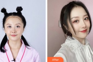 海南夢(mèng)妮幻整形?？崎T(mén)診部費(fèi)艷麗整形價(jià)格表附植發(fā)案例展示