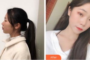 海南夢(mèng)妮幻整形?？崎T(mén)診部史雅丹主診醫(yī)師整形價(jià)格表附皮膚美容案例展示