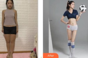 云南瑪麗亞整形美容醫(yī)院馮小良整形價格表附吸脂案例展示