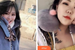 云南華美美萊美容醫(yī)院鄒慶整形價格表附水氧活膚案例展示