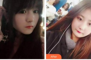 云南德普口腔醫(yī)院全允植整形價格表附根管調(diào)節(jié)案例展示