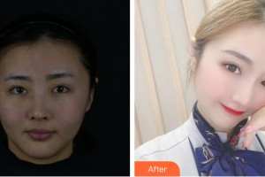 海南星之美醫(yī)療美容門診部劉曉艷整形價格表附皮膚美容案例展示