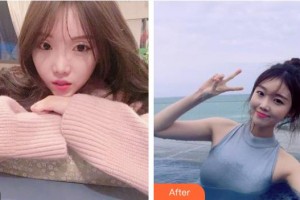 昆明天倫婦產(chǎn)醫(yī)院醫(yī)學(xué)整形美容中心米娜主診醫(yī)師整形價(jià)格表附鼻部綜合案例展示