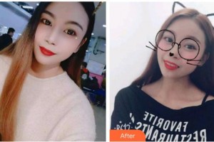 昆明超然醫(yī)學(xué)整形美容外科醫(yī)院申晶整形價(jià)格表附牙貼面案例展示