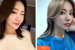 昆明前衛(wèi)美眼整形?？圃\所馮曉明整形價(jià)格表附鼻部綜合案例展示