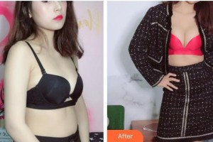 昆明薇莎整形美容醫(yī)院李銀石整形價(jià)格表附自體脂肪隆胸案例展示