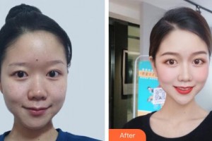 昆明皮膚病?？漆t(yī)院黃文標(biāo)整形價(jià)格表附激光祛斑案例展示