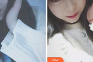 昆明皮膚病專科醫(yī)院王正文整形價格表附眼部綜合案例展示