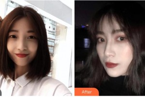 昆明愛(ài)爾眼科醫(yī)院孫鵬整形價(jià)格表附眼部綜合案例展示