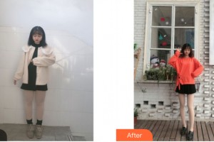 南寧賀爾美醫(yī)療美容門診部張永喆整形價(jià)格表附大腿吸脂案例展示