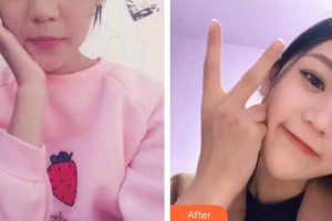 昆明眼科醫(yī)院馮雁整形價格表附定點(diǎn)雙眼皮案例展示