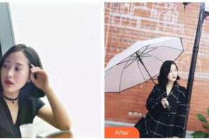 昆明吳氏嘉美美容醫(yī)院張?jiān)屏嵴蝺r(jià)格表附金屬托槽矯正案例展示