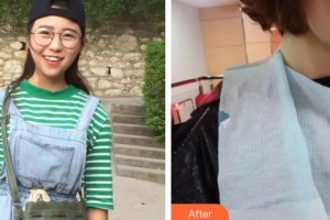 昆明愛齊口腔門診部朱婭整形價(jià)格表附牙齒隱形矯正案例展示