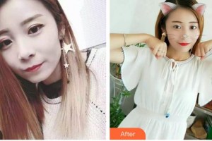 昆明市口腔醫(yī)院苗潤州整形價(jià)格表附冷光美白案例展示