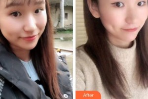 曲靖口腔醫(yī)院孟偉整形價(jià)格表附牙貼面案例展示