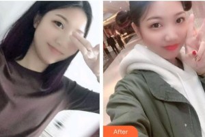 曲靖卓美口腔門診部陳吉林整形價(jià)格表附根管調(diào)節(jié)案例展示