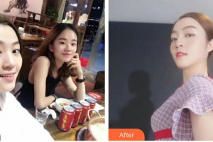 昭通瑪麗婦產醫(yī)院整形美容科韓受亨整形價格表附隆鼻案例展示