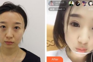 河北醫(yī)科大學(xué)第三醫(yī)院燒傷整形外科曹莫整形價格表附眼部綜合案例展示