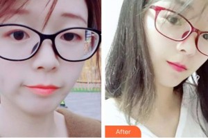 石家莊貴美人醫(yī)療美容醫(yī)院鄒慧嫻整形價格表附微針?biāo)獍咐故?>
</a>
<h3 class=