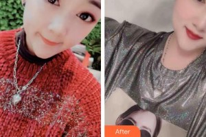 石家莊冀美醫(yī)療美容門診部王立英整形價格表附鼻部整形案例展示