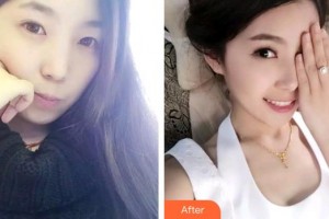 石家莊樂仁堂萬瑞醫(yī)療美容門診部侯彥博整形價格表附牙齒隱形矯正案例展示