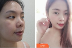 石家莊美萊醫(yī)學(xué)美容醫(yī)院李珊珊整形價格表附無針?biāo)獍咐故?>
</a>
<h3 class=