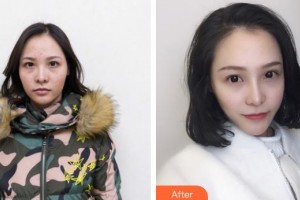 石家莊愛(ài)瑞爾醫(yī)療美容診所蘆斌整形價(jià)格表附眼部綜合案例展示