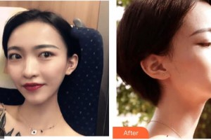 石家莊愛(ài)瑞爾醫(yī)療美容診所賈廣英整形價(jià)格表附光子嫩膚案例展示