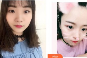 石家莊愛(ài)瑞爾醫(yī)療美容診所李聰整形價(jià)格表附眼部綜合案例展示