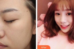 唐山星范醫(yī)療美容門(mén)診部杜太超整形價(jià)格表附眼部綜合案例展示