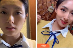 唐山美聯(lián)臣醫(yī)療美容醫(yī)院文丁一整形價(jià)格表附埋線提升案例展示