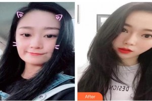 唐山冀東眼科醫(yī)院李耀宇整形價(jià)格表附超聲提拉案例展示