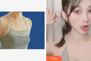 ?？跂|湖醫(yī)學(xué)美容整形醫(yī)院周旭剛整形價格表附自體脂肪豐胸案例展示