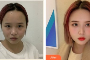 ?？跂|湖醫(yī)學(xué)美容整形醫(yī)院梁輝整形價格表附皮膚美容案例展示