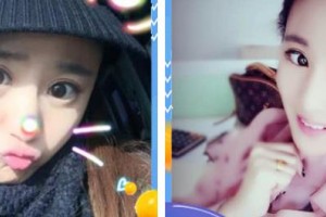 秦皇島巧致美容醫(yī)院胡巧致整形價格表附切開雙眼皮案例展示