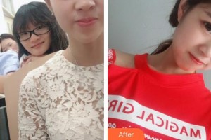 秦皇島愛爾眼科醫(yī)院錢曼整形價格表附眼部綜合案例展示