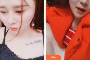 秦皇島口腔醫(yī)院呂楨整形價格表附超聲波潔牙案例展示