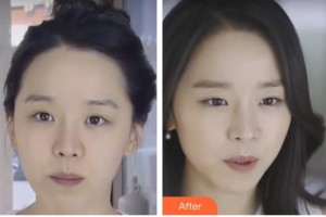 邯鄲都市整形美容醫(yī)院魯樹榮整形價格表附激光除皺案例展示