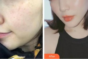 邯鄲都市整形美容醫(yī)院倪云志整形價格表附激光美膚激光案例展示