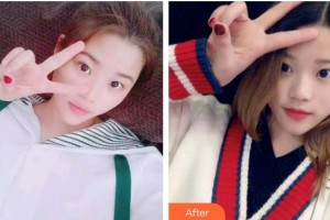 保定牙博士口腔醫(yī)院張亮整形價格表附冷光美白案例展示