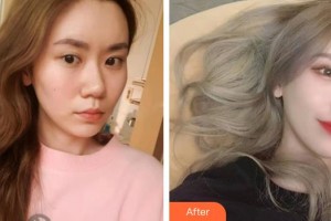 保定新視眼科醫(yī)院劉芳整形價格表附眼部綜合案例展示