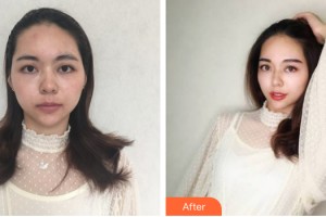 中山百佳婦產(chǎn)醫(yī)院醫(yī)療美容科孫玥玥整形價(jià)格表附雙眼皮手術(shù)案例展示