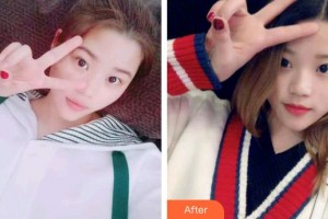 滄州市中心醫(yī)院醫(yī)學(xué)整形美中心馬超整形價格表附冷光美白案例展示