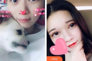 滄州眼科醫(yī)院李亞楠整形價格表附定點雙眼皮案例展示