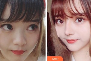 廊坊頤美佳醫(yī)療美容醫(yī)院黃綠萍整形價格表附鼻部綜合案例展示