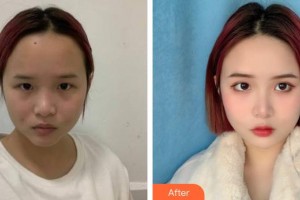 衡水天宏醫(yī)療美容醫(yī)院王鳳蘭整形價(jià)格表附無(wú)針?biāo)饫故?>
</a>
<h3 class=