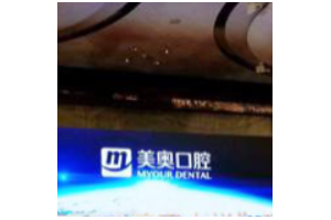 長(zhǎng)沙美萊整容醫(yī)院好么  假體隆鼻果分享案例果圖