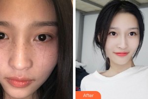 西寧友健美容整形醫(yī)院劉素琴整形價(jià)格表附皮膚美容案例展示