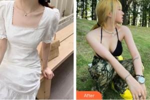 西寧友健美容整形醫(yī)院郝磊整形價(jià)格表附隆胸手術(shù)案例展示