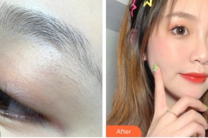 西寧欣怡醫(yī)學整形美容門診部王若名整形價格表附紋眉案例展示